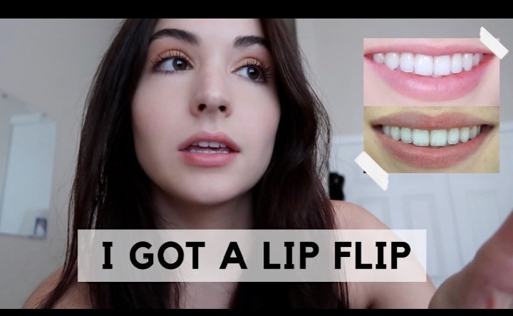 Lip Flip